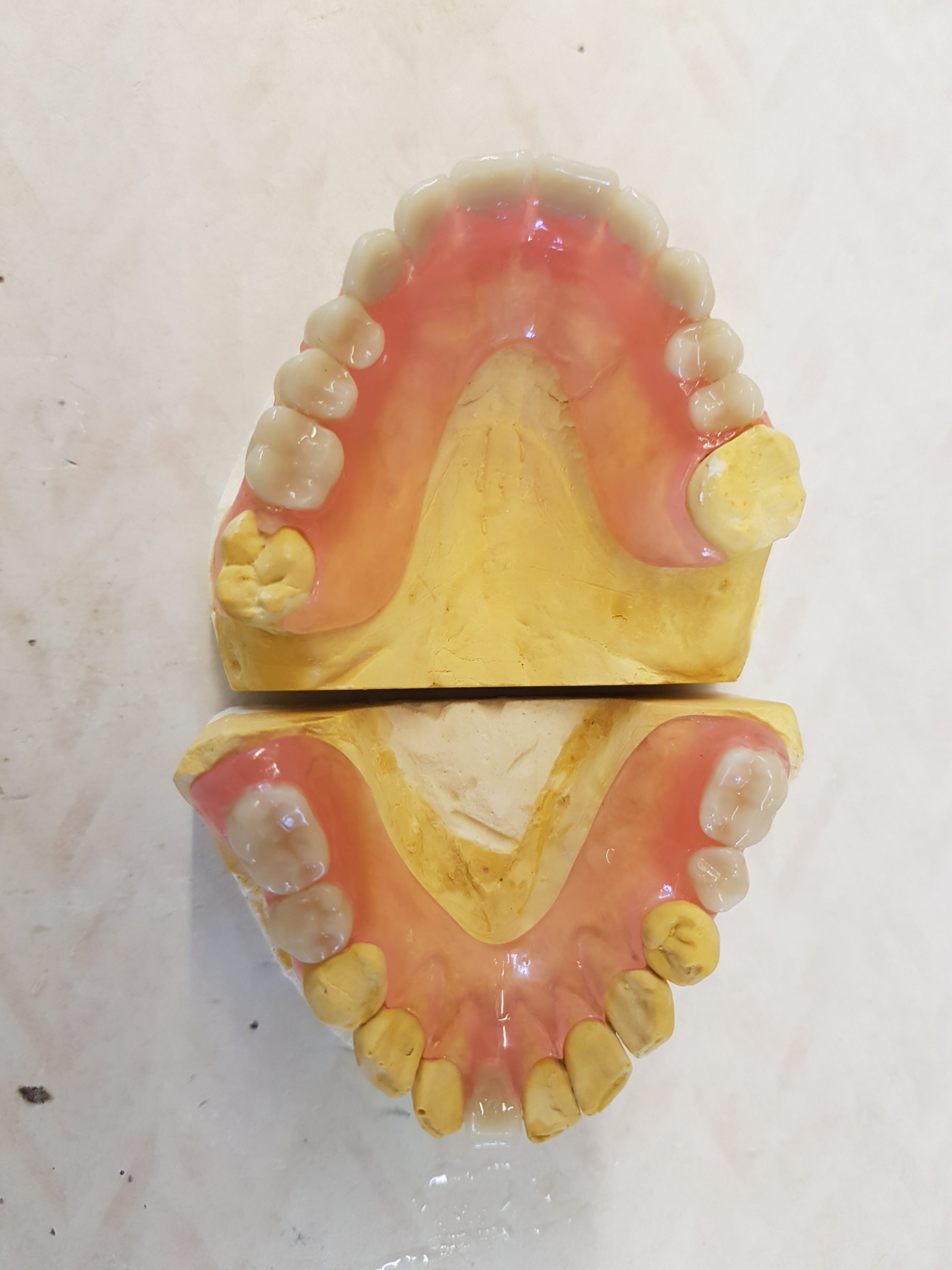 Valplast Flexible Dentures